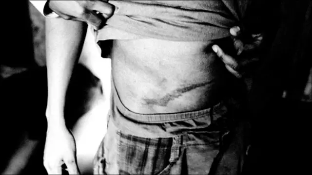 Порез на животе мальчика 