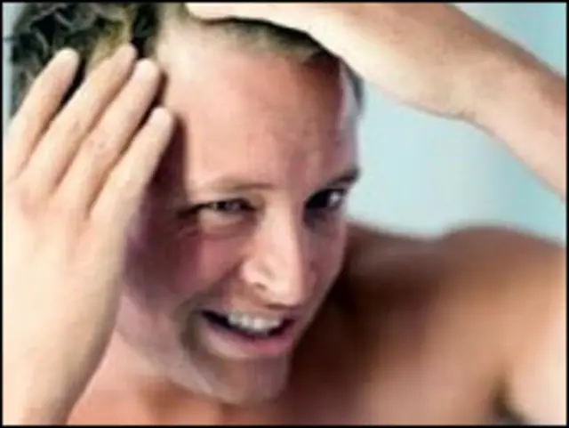 سر بیش از نیمی از مردان پنج سال به بالا تا حدودی طاس شده است و ریزش شدید مو در برخی از مردان از بیست و چند سالگی آغاز می شود