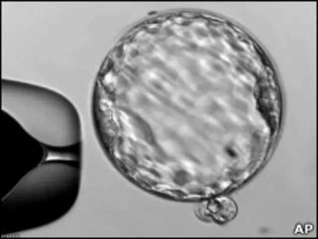 Стволовые клетки