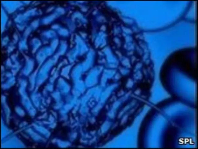 स्टेम सेल