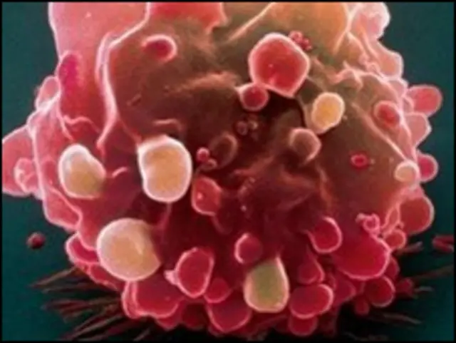 Клетки рака