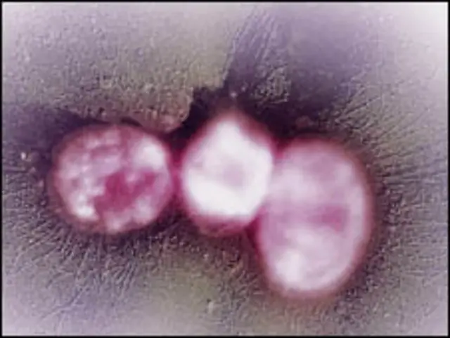 Klebsiella pneumoniae Carbapenemase (Foto: Fred Hossler/Visuals Unlimited/Scicence Photo Library)