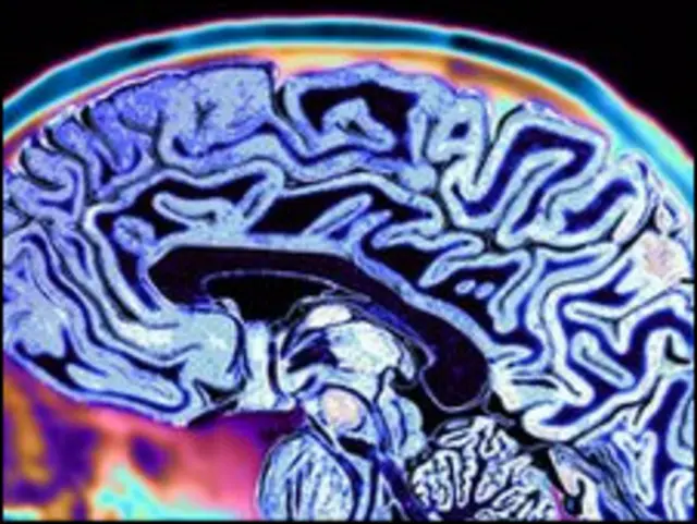 پژوهشگران شیوه ای برای ثبت فعالیت های مغزی بالا بوجود آورده اند