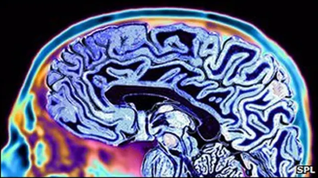 Инсон мияси тасвири