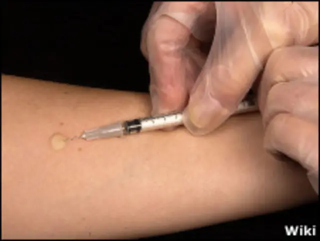 टीबी मरीज