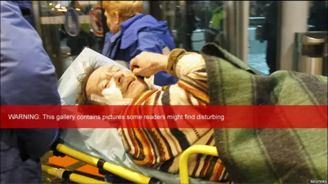 Korban ledakan bom Moskow