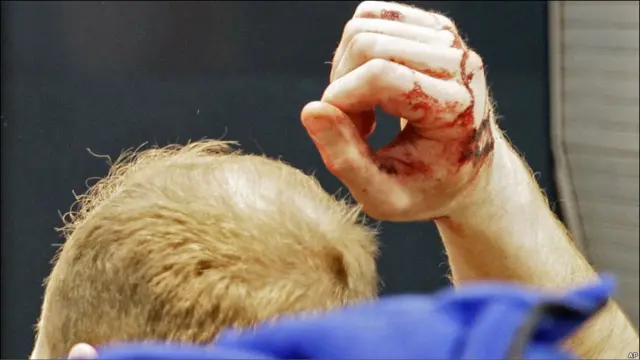 Korban ledakan bandara Moskow