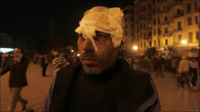 在衝突中受傷的反對派示威者（02/02/2011）