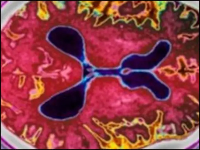 Сканування людського мозку