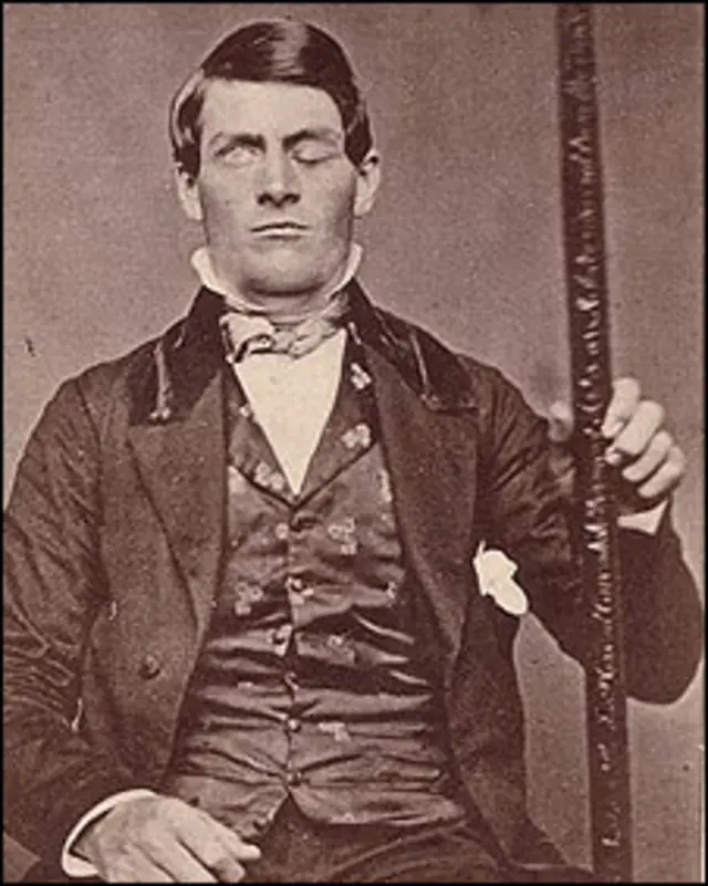 Phineas Gage