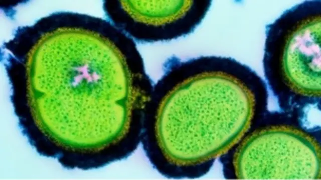 Estafilococo dorado resistente a la meticilina (EDRM)