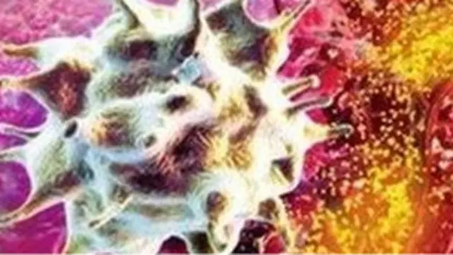 Célula T atacando a un tumor (SPL)