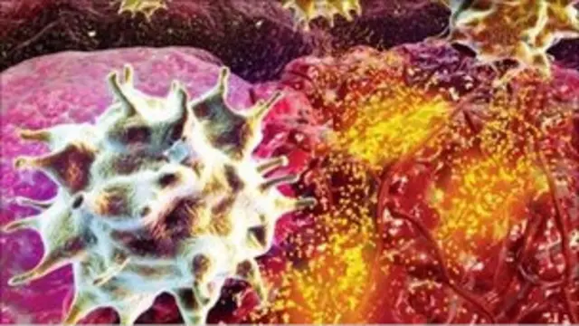 خلايا سرطانية