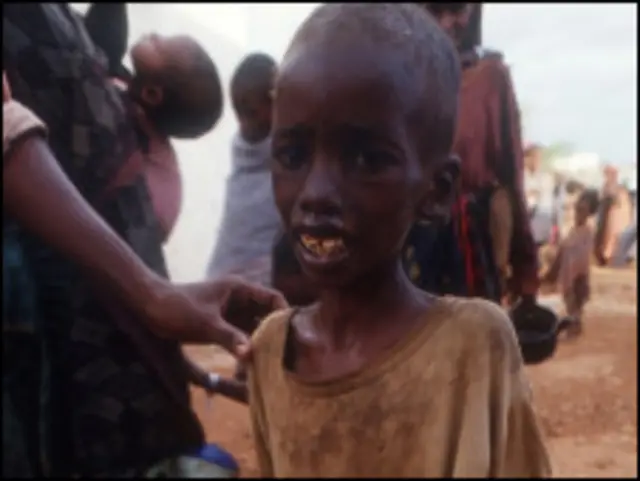 مہاجر بچے کم خوراکی اور پانی کی قلت کی وجہ سے شدید متاثر ہوئے ہیں