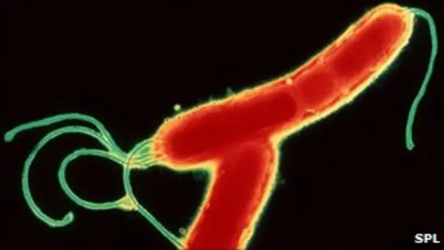 باکتری هلیکو باکتر پیلوری helicobacter pylori