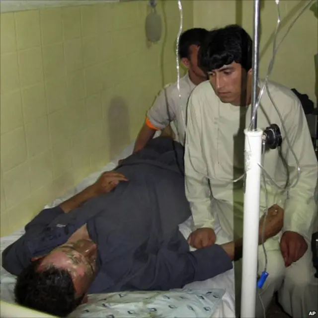 طبي کارکوونکي په برید کې د یوه ټپي درملنه کوي. چارواکي وايي چې په ټپیانو کې د تخار والي عبدالجبار تقوا هم شامل دی. 