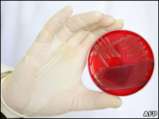 Cientista mostra cultivo de colônia de bactérias E.coli responsáveis por surto de infecções na Alemanha