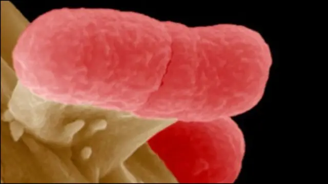 ई-कोलाई बेक्टीरिया