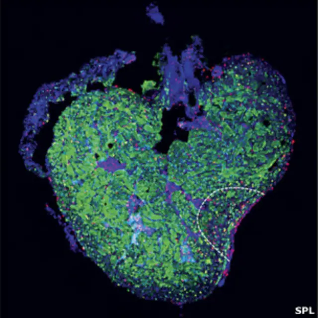 Снимок сердца человека
