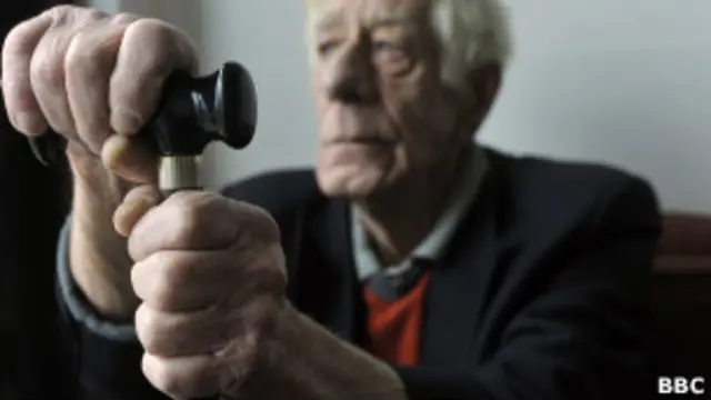 مئات الآلاف في العالم يعانون من الزهايمر