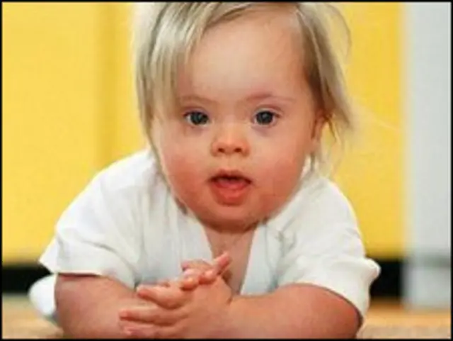 दवाओं की मदद से कृत्रिम गर्भाधान से असामान्य बच्चे पैदा होने के ख़तरे बढ़ सकते हैं