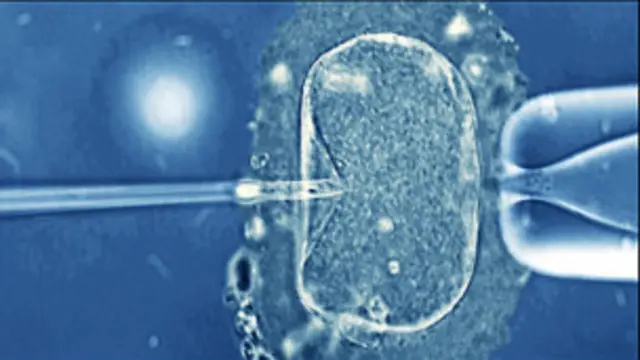 இன் வித்ரோ ஃபெர்டிலைஸேஷன் முறையில் உடலுக்கு வெளியில் விந்தும் கருமுட்டையும் சேர்க்கப்படுகிறது