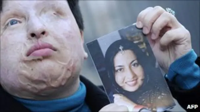 Ameneh Bahrami mengatakan dia mengampuni penyerang "demi negaranya"