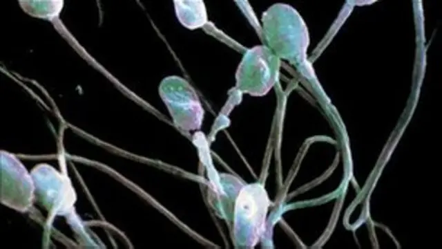 Erotik mazmundagi gozal sherlar