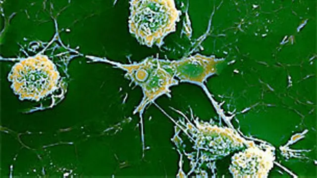 سلول های عصبی و فرایند ام اس