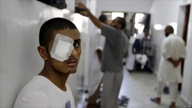 Поранений солдат Каддафі в шпиталі Місурати