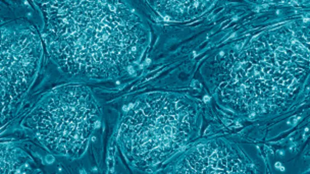 भ्रूणीय स्टेम सेल