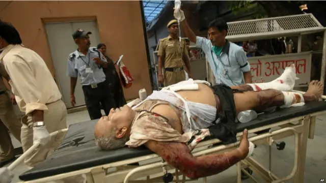 stretchered victim