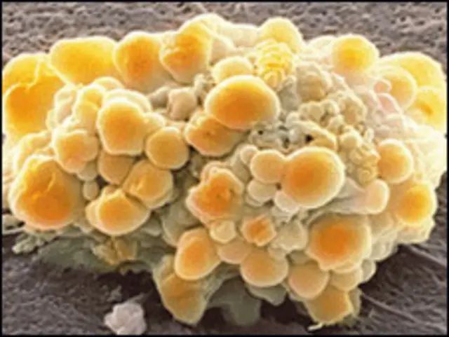 ادارے کے مطابق اٹھائیس لاکھ تازہ سالانہ کیسز کا کسی نا کسی طرح تعلق خوراک، ورزش یا موٹاپے سے ہے