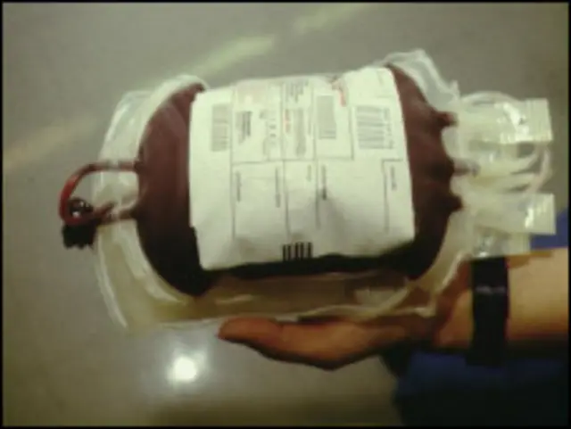 خون کی تھیلی: فائل فوٹو