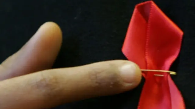 په پرمختللو هېوادونو کې د اېډز وایروس ډېر دی