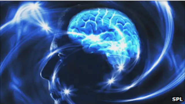 صورة للدماغ