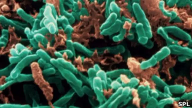 माइक्रोस्कोप से ली गई तपेदिक के जीवाणु की तस्वीर.