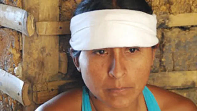 Pobladora del resguardo de Huellas herida por la explosión