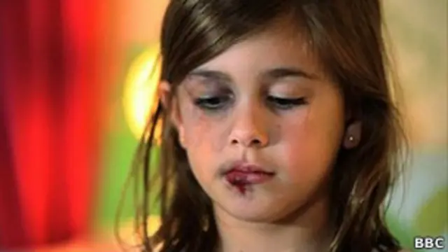 Миллионы американских детей каждый год страдают от побоев и тысячи погибают вследствие жестокого обращения