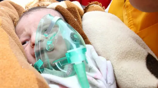 Bayi yang selamat dari gempa Turki