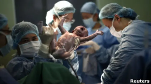 刚出生的婴儿。