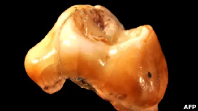 Молочный зуб - один из обнаруженных в Италии