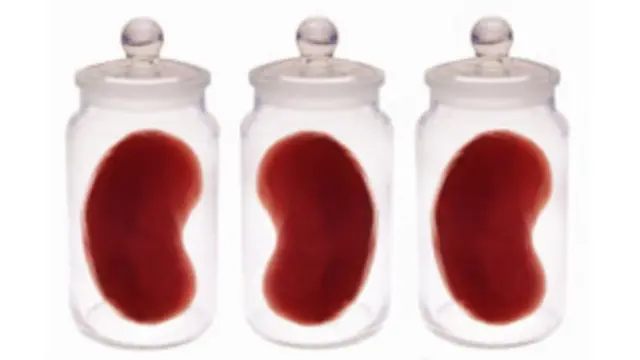 報道稱,一名健康青年男子的腎臟目前在中國的市場價格為3.5萬元人民幣。