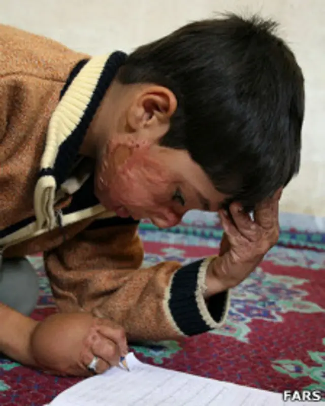 دیه دانش‌آموزان آسیب‌دیده درودزن پنج سال بعد از حادثه آتش‌سوزی در مدرسه به والدینشان تحویل داده شد