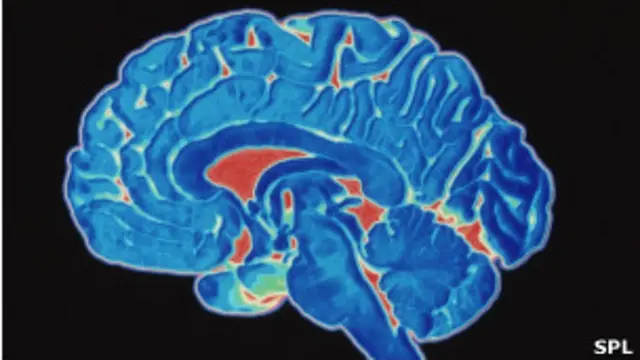 Tomografia de cérebro.