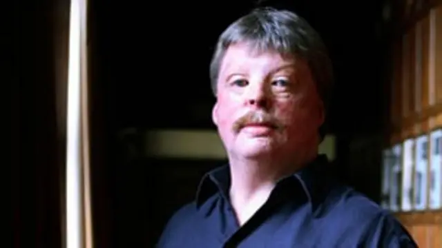Simon Weston