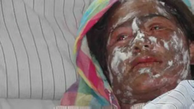 भारत , पाकिस्तान, अफगानिस्तान जैसे देशों में सबसे ज़्यादा मामले देखने को मिलते हैं (फाइल फोटो)