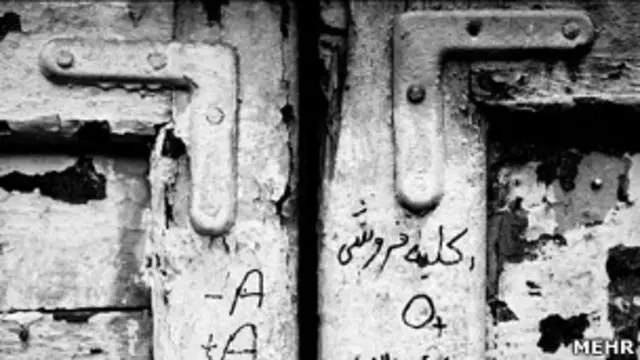 آگهی فروش کلیه