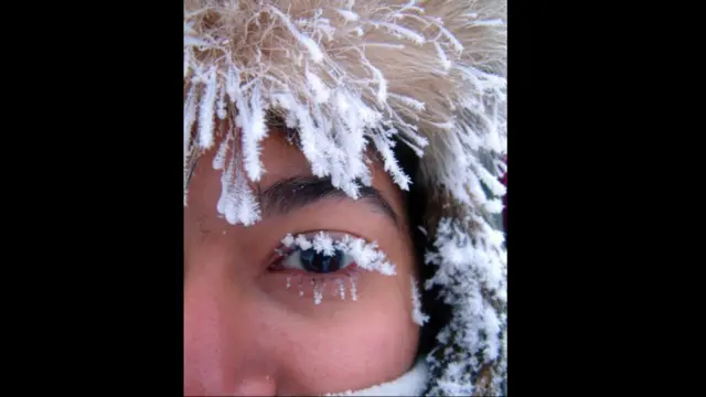 درجہء حرارت منفی پینتیس ڈگری سینٹی گریڈ تک پہنچ جانے کے باعث بالوں اور پلکوں پر بھی برف جمنے لگی ہے۔ 