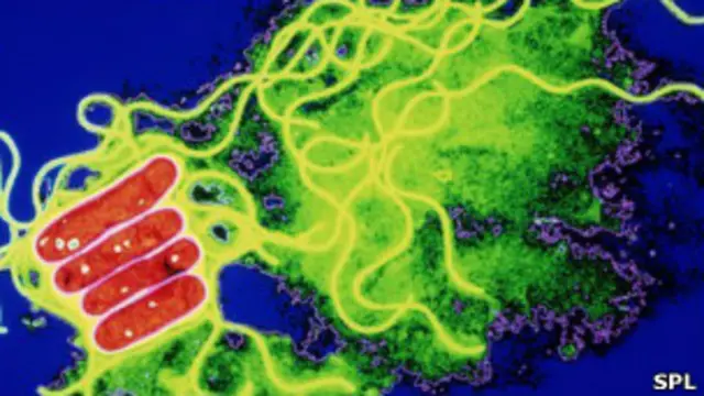 Бактерии легионеллы